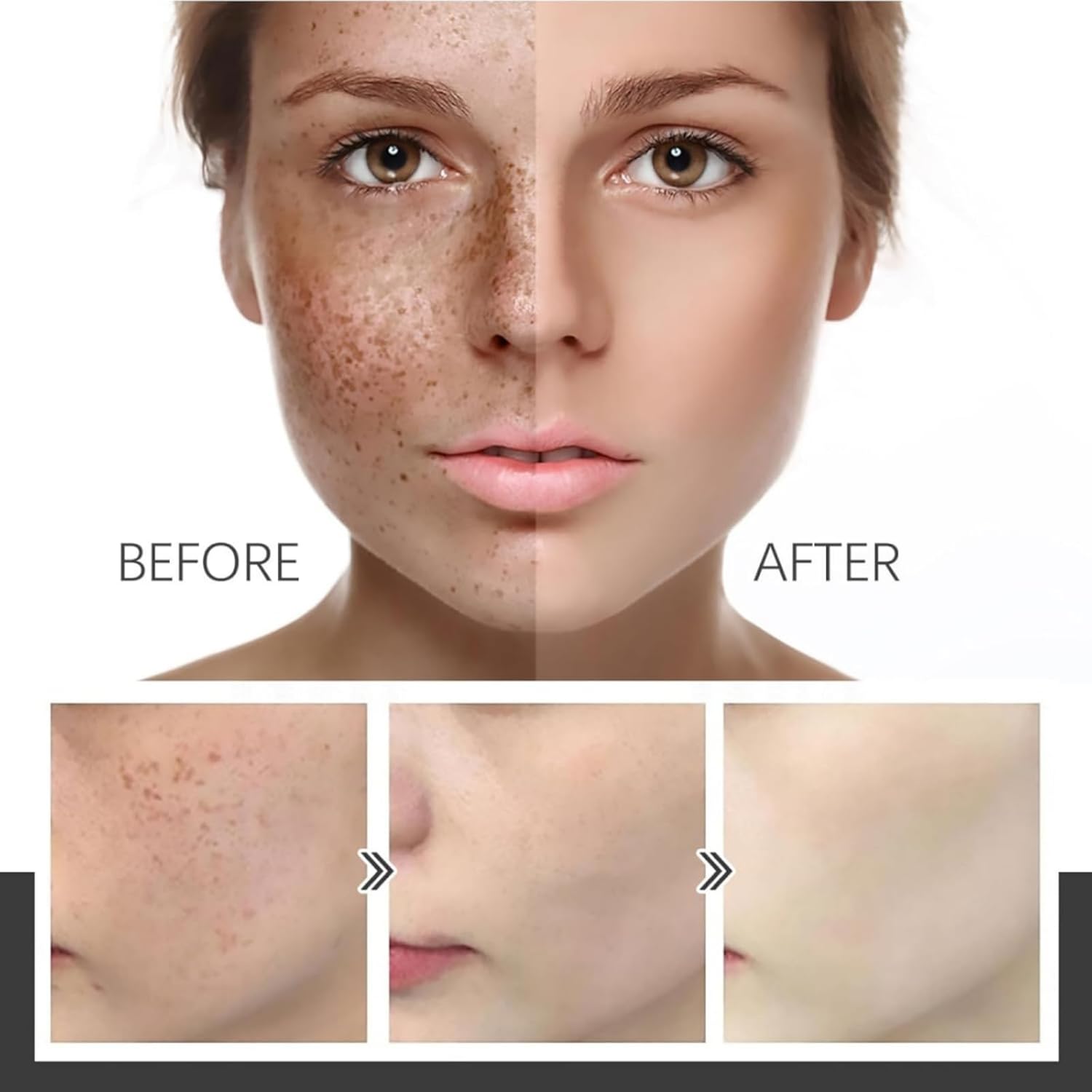 Aobenz Dark Spot Remover